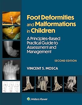 (PDF)Foot Deformities and Malformations in Children: A Principles-Based, Practical Guide to Assessment and Management 2nd Edition