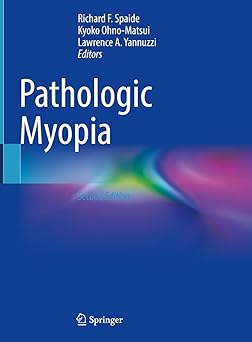(PDF)Pathologic Myopia 2nd Edition
