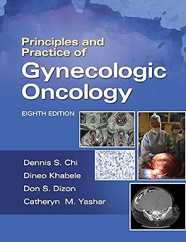(PDF)Principles and Practice of Gynecologic Oncology 8th Edition