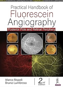 (PDF)Practical Handbook of Fluorescein Angiography: Posterior Pole and Retinal Periphery 2nd Edition
