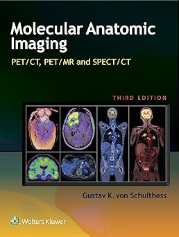 (PDF)Molecular Anatomic Imaging: PET/CT, PET/MR and SPECT CT 3rd Edition