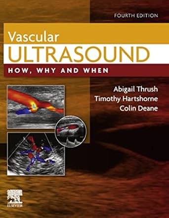 (PDF)Vascular Ultrasound E-Book: How, Why and When 4th Edition